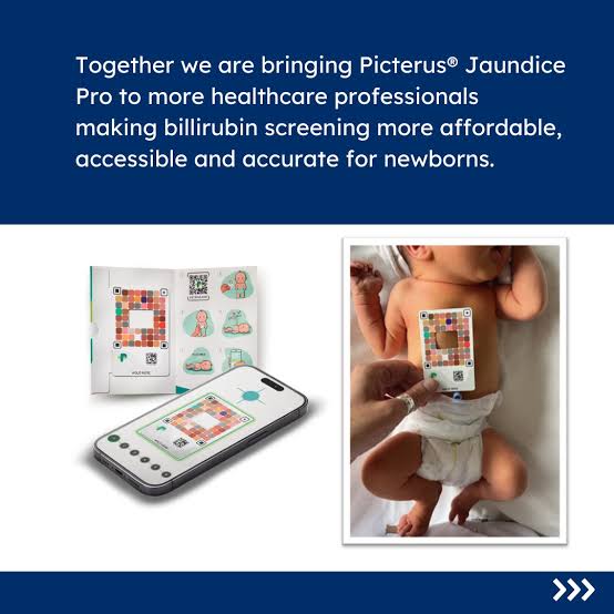 Picterus Jaundice Pro
