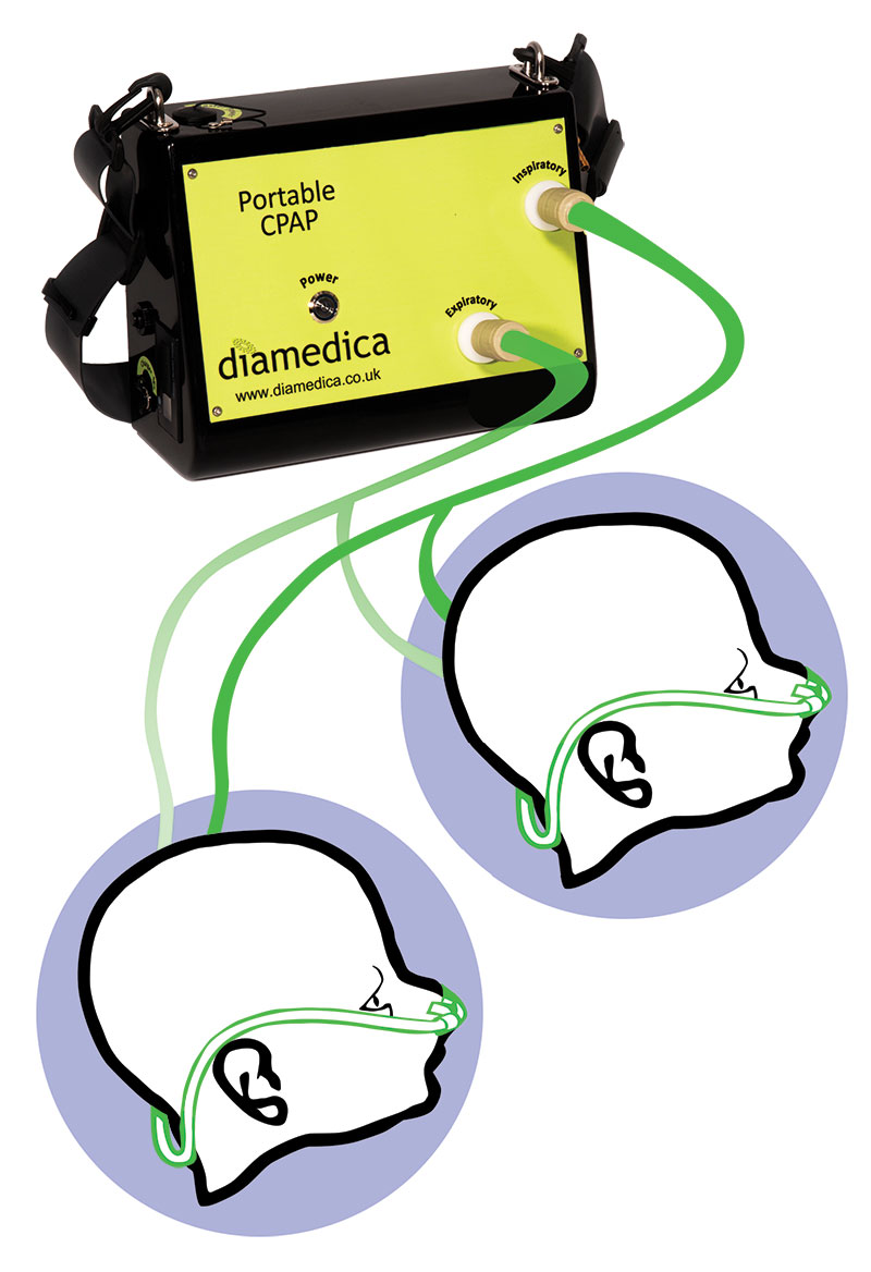 Diamedica Portable Baby CPAP