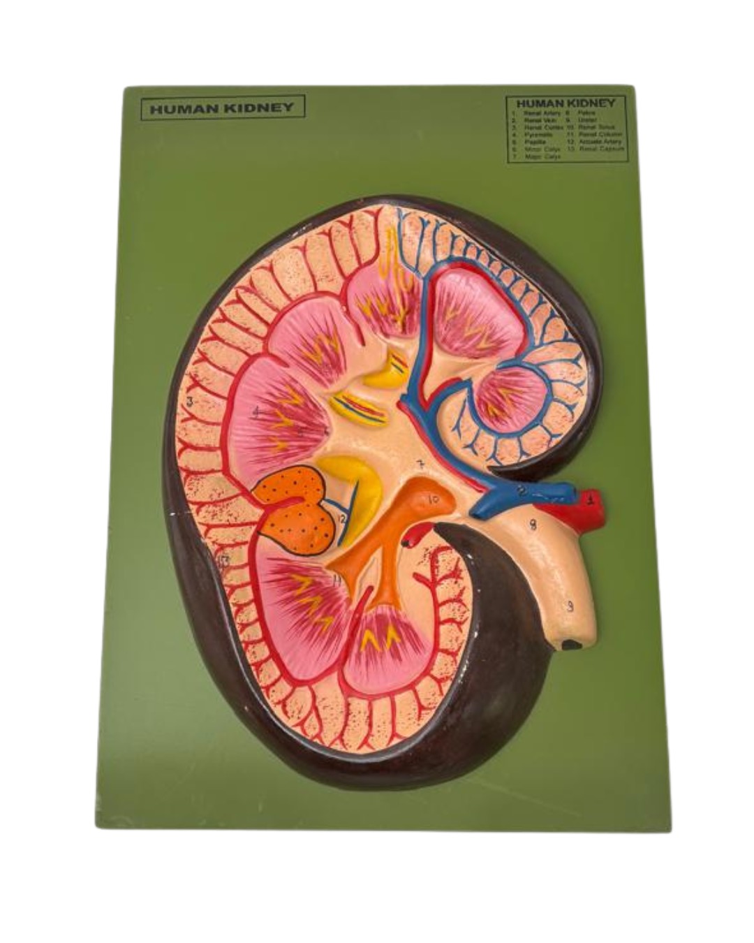 Human Kidney Model