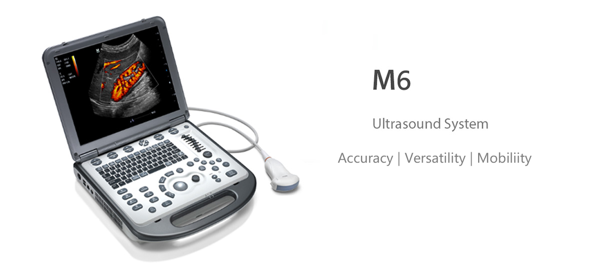 M6