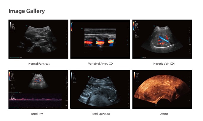 Mindray Consona N6 Diagnostic Ultrasound System