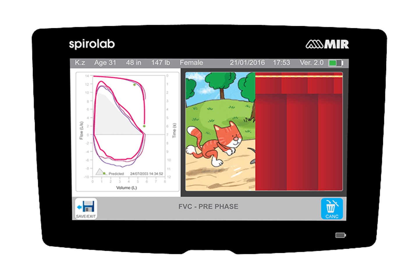 Spirometer – Spirolab