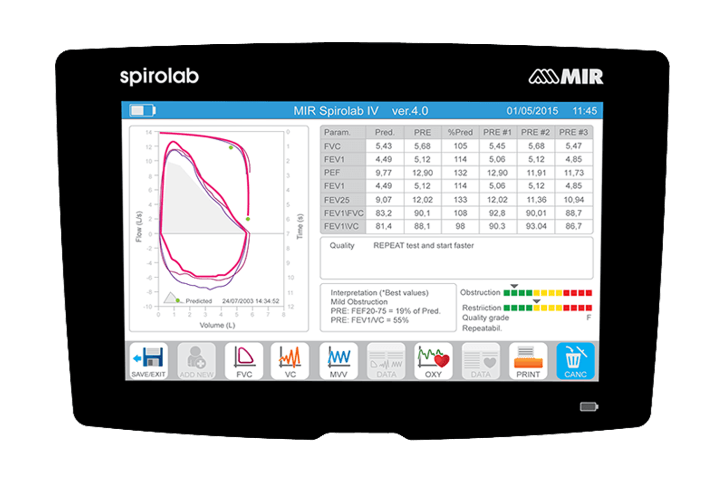 Spirometer – Spirolab